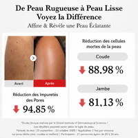 Duo Peel Shot Acide Hypochloreux & Riz — Visage + Corps
